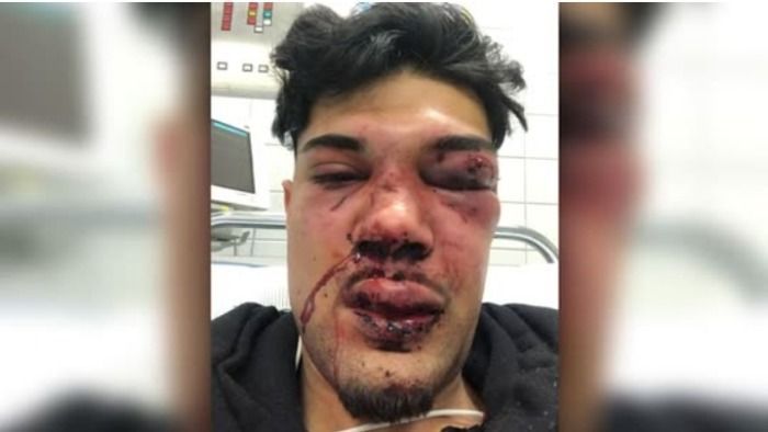 Jugendlicher (23) in Köln - Dünnwald ins Krankenhaus geprügelt
